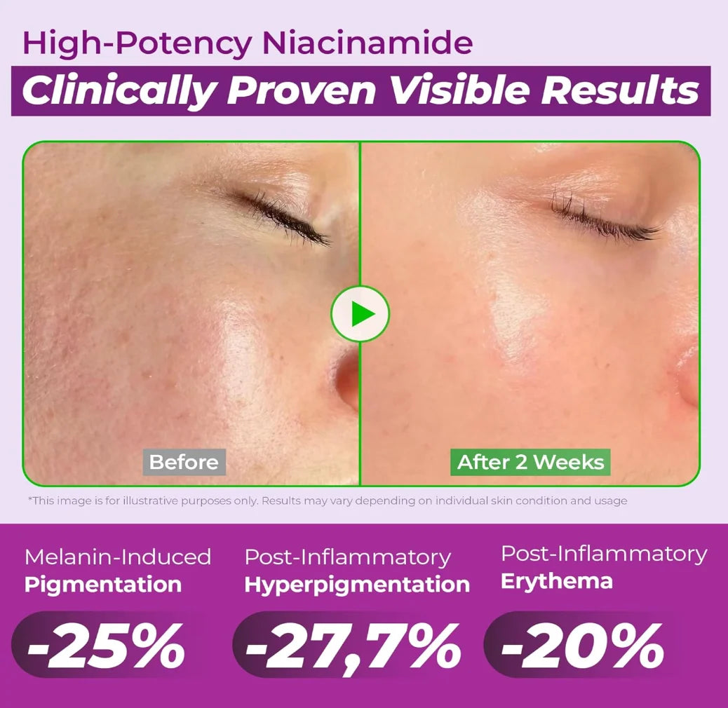 JUMISO Niacinamide 20 sérum