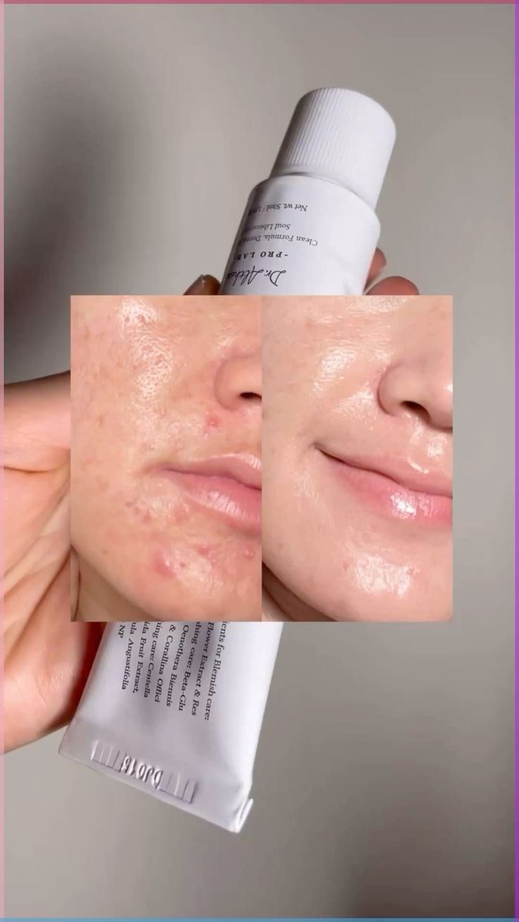 DR ALTHEA 345 Relief Cream 50 ML
